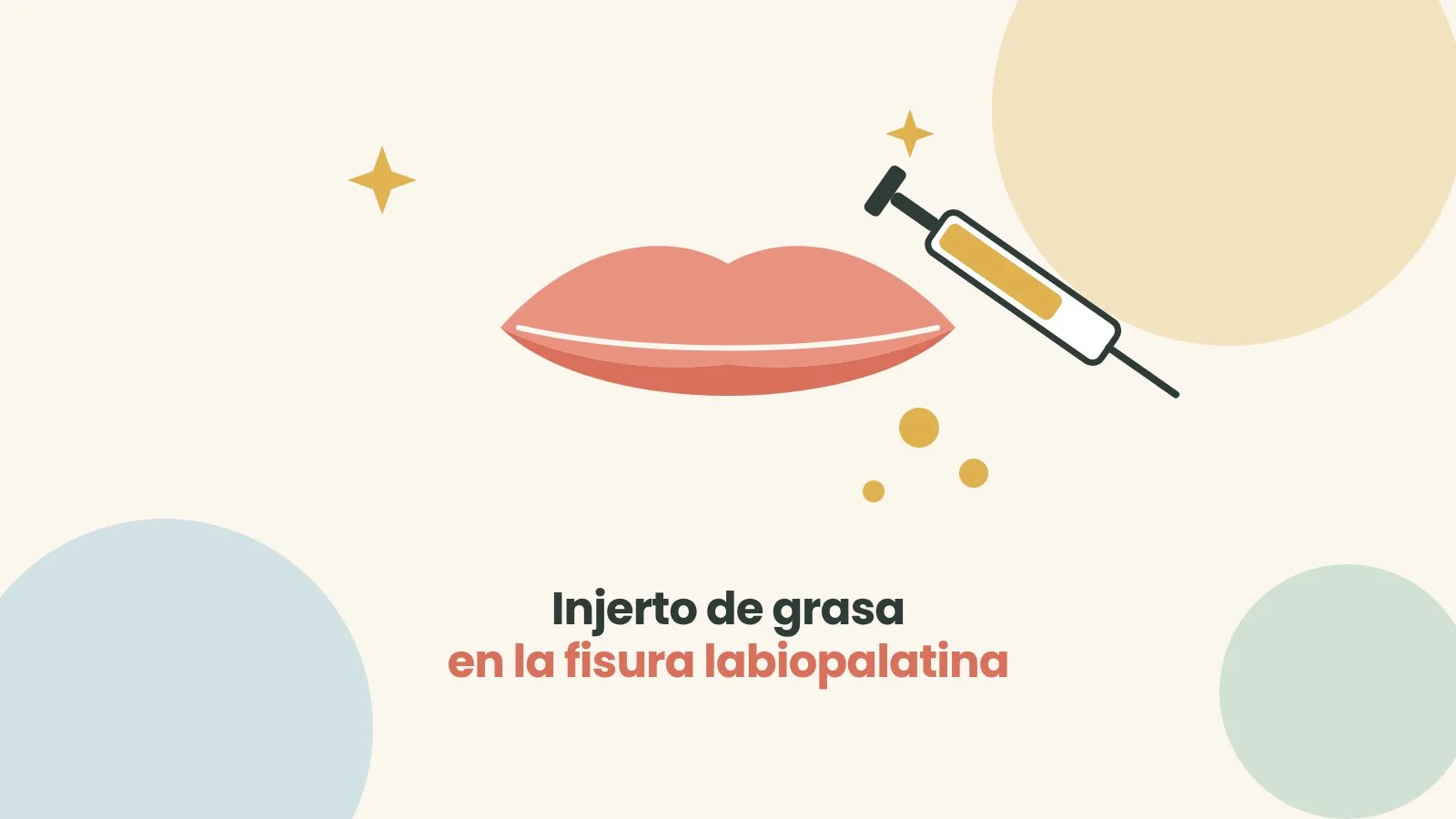 Injerto de grasa en la fisura labiopalatina. Ilustración: ASPANIF